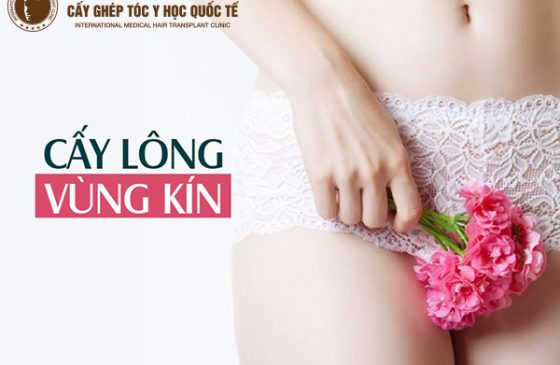 cấy lông mu ở Hà Nội