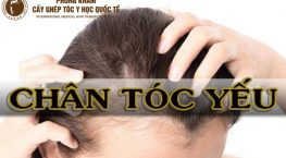 chân tóc yếu gãy rụng nhiều