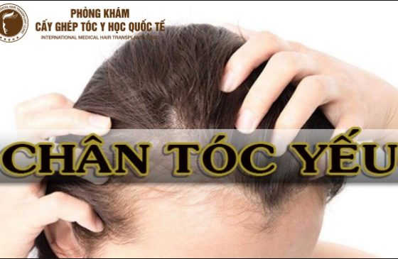 chân tóc yếu gãy rụng nhiều