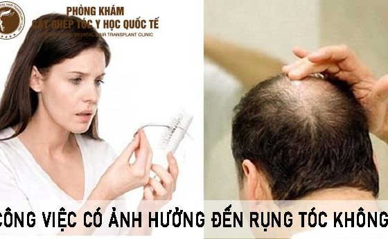 công việc có ảnh hưởng đến rụng tóc không