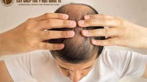 hiện tượng rụng tóc nhiều ở nam giới