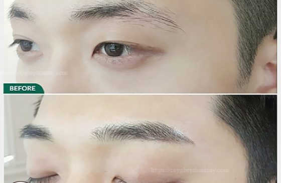 lông mày thưa mỏng