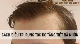rụng tóc do tăng tiết bã nhờn
