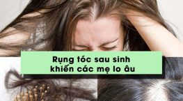 sinh con xong tóc rụng nhiều