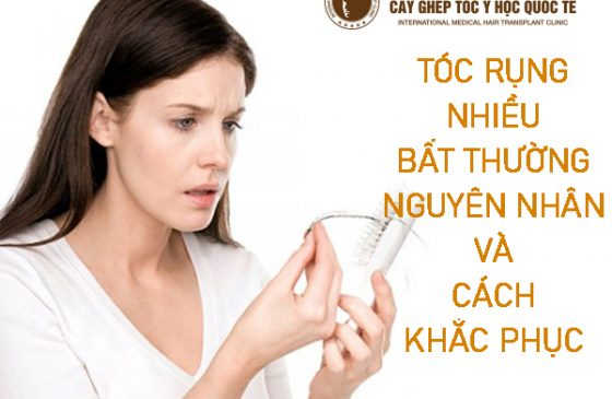 tóc rụng nhiều bất thường