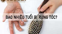 bao nhiêu tuổi bị rụng tóc