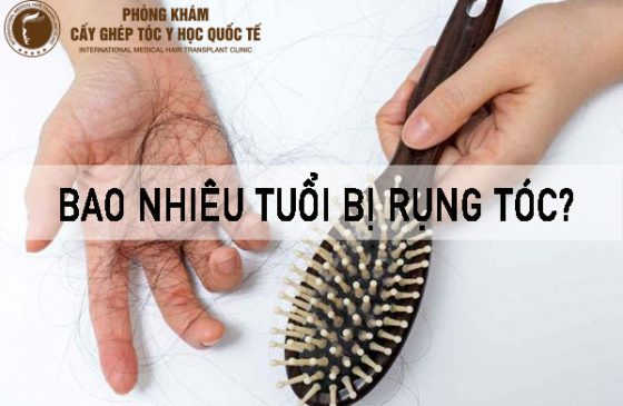bao nhiêu tuổi bị rụng tóc