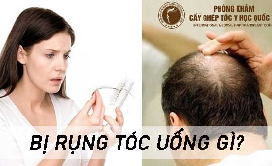 bị rụng tóc uống gì