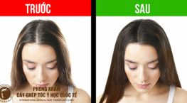 cách giúp tóc nhiều và dày