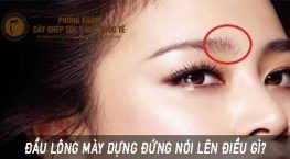 đầu lông mày dựng đứng