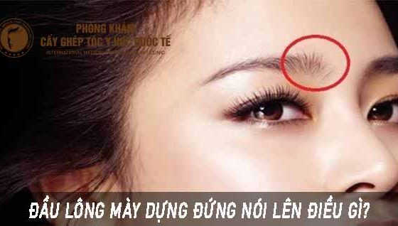 đầu lông mày dựng đứng