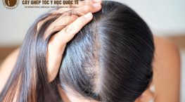 Đầu rụng ít tóc