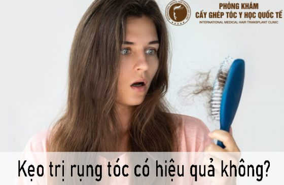 kẹo trị rụng tóc