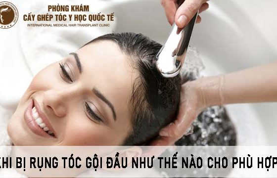 khi bị rụng tóc gội đầu như thế nào cho phù hợp