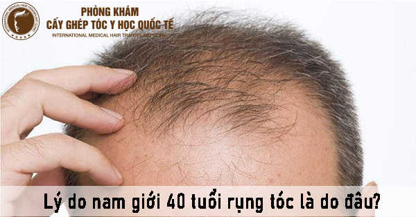 lý do nam giới 40 tuổi rụng tóc là do đâu