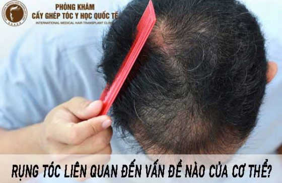 rụng tóc liên quan đến vấn đề nào của cơ thể