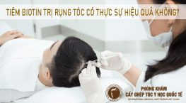 tiêm biotin trị rụng tóc