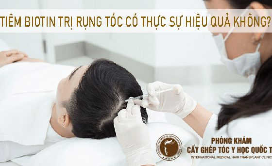 tiêm biotin trị rụng tóc