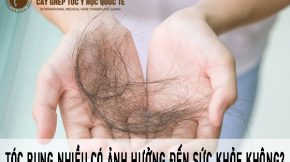 Tóc rụng nhiều có ảnh hưởng đến sức khỏe không