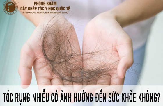 Tóc rụng nhiều có ảnh hưởng đến sức khỏe không