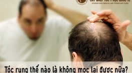 tóc rụng thế nào là không mọc lại được nữa