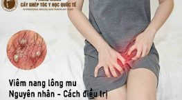 viêm nang lông mu