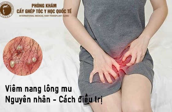 viêm nang lông mu