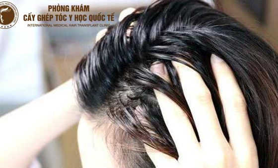 đầu tóc mồ hôi dầu phải làm sao