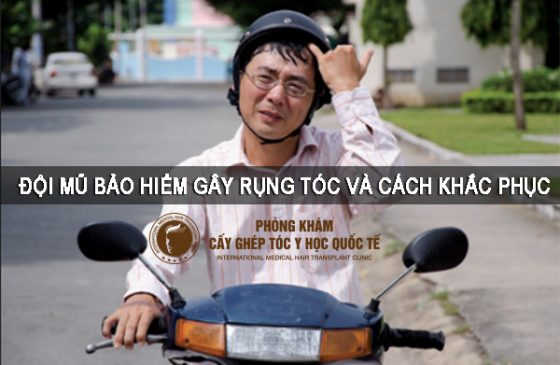 đội mũ bảo hiểm gây rụng tóc