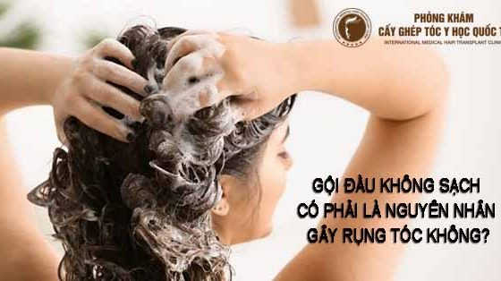 Gội đầu không sạch có phải là nguyên nhân gây rụng tóc không