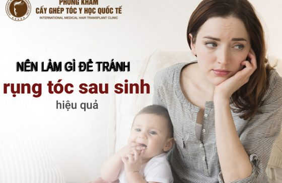 nên làm gì để tránh rụng tóc sau sinh