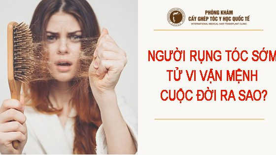Người rụng tóc sớm tử vi vận mệnh cuộc đời ra sao