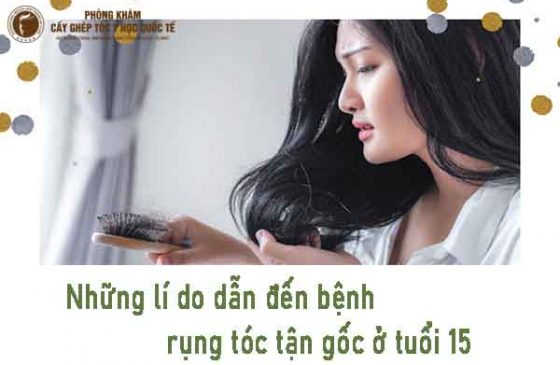những lí do dẫn đến bệnh rụng tóc tận gốc ở tuổi 15