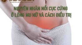 nguyên nhân nổi cục cứng ở lông mu nữ và cách điều trị