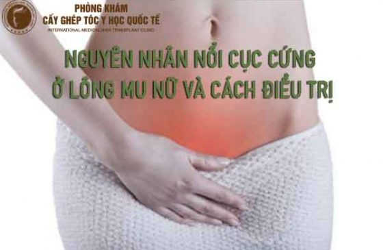 nguyên nhân nổi cục cứng ở lông mu nữ và cách điều trị