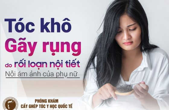 rụng tóc nhiều và nổi mụn vì rối loạn nội tiết