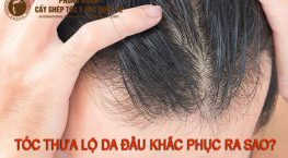 tóc thưa lộ da đầu