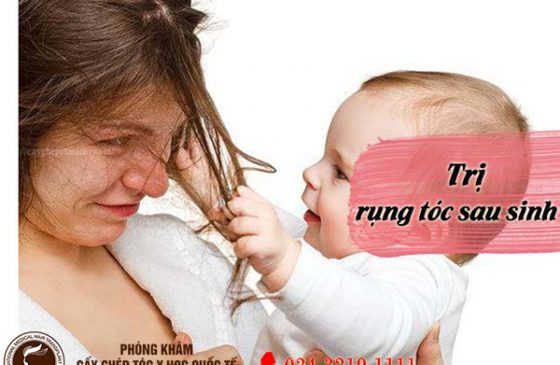 cách chống rụng tóc dùng cho người cho con bú