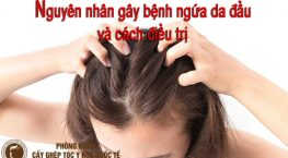 nguyên nhân gây bệnh ngứa da đầu