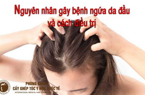 nguyên nhân gây bệnh ngứa da đầu