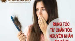 rụng tóc từ chân tóc nguyên nhân