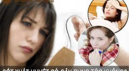 sốt xuất huyết có gây rụng tóc không