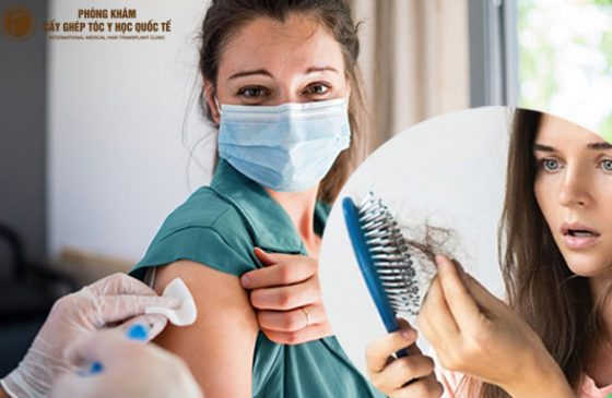 tiêm vaccin covid rụng tóc