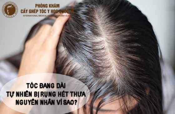 tóc đang dài tự nhiên bị rụng thưa hết nguyên nhân vì sao