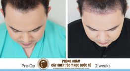 260 Nguyễn Đình Chiểu, Phường 06, Quận 03, TP HCM