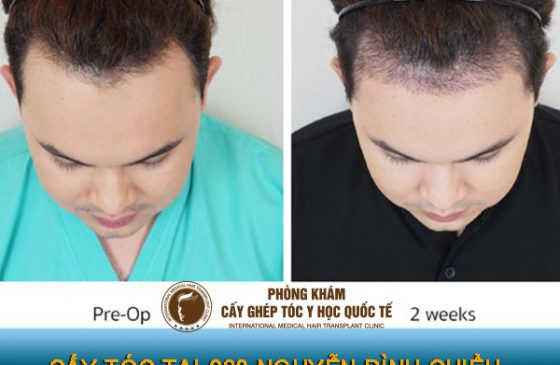 260 Nguyễn Đình Chiểu, Phường 06, Quận 03, TP HCM