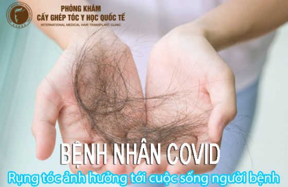 bệnh nhân covid rụng tóc