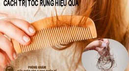 cách trị tóc rụng hiệu quả