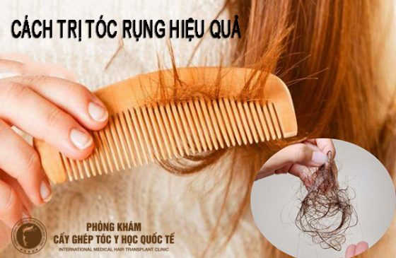 cách trị tóc rụng hiệu quả