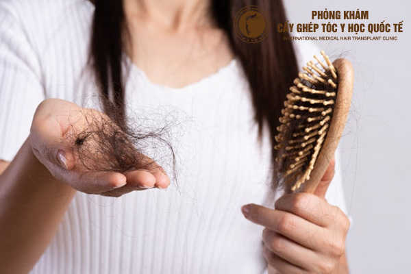 cách trị tóc rụng hiệu quả